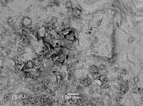 Backscatter and Secondary Electron Imaging using Scanning Electron Microscopy (SEM)